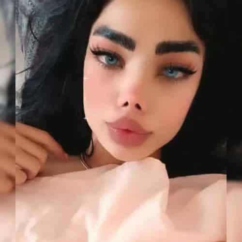 رها پیت قبل از عمل